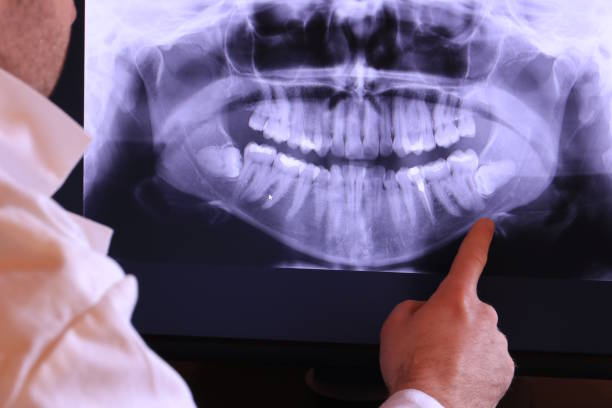 Best Emergency Root Canal Therapy in Hawkinsville, GA